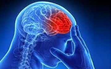 راهکاری برای کاهش خطر سکته مغزی