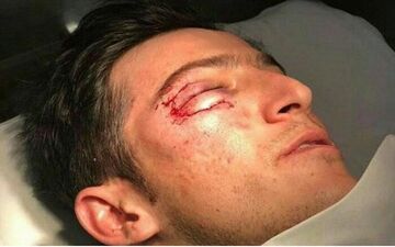 مصدومیت شدید سردار در تمرین امروز روبین کازان