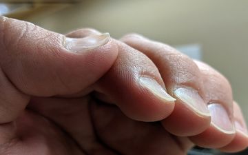 از روی شکل و رنگ ناخن پی به بیماری تان ببرید