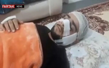 مشاهدات عینی سرباز مجروح ناجا در پاسداران + فیلم