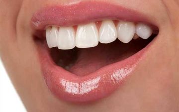 لبخندی درخشان و سفید با پیشگیری و راه های از بین بردن سیاهی دندان
