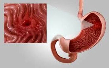 کدام یک از سبزیجات باعث زخم معده میشوند؟