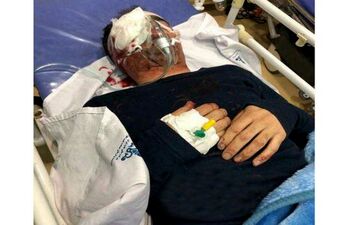 حادثه وحشتناک برای تکنسین هواپیما در اهواز / چشم او تخلیه شد + عکس
