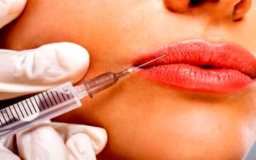 راز لب‌های طبیعی و جذاب: چقدر ژل تزریق کنیم که مصنوعی نشه؟