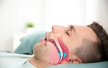 دلایل عرق سرد چیست؟| حتما به این موضوع توجه کنید!
