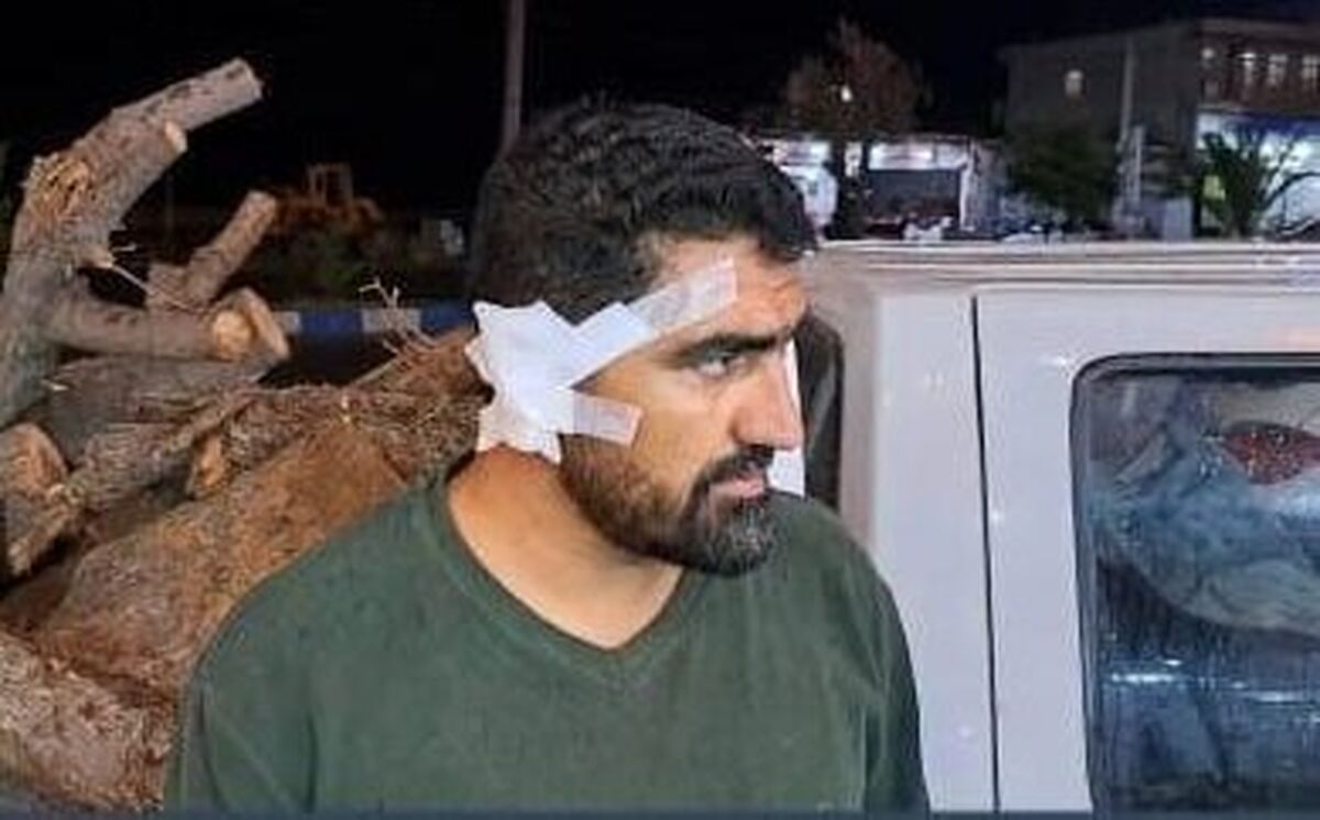 حمله وحشیانه سودجویان به مامور منابع طبیعی باشت؛ گوش مامور پاره شد!

