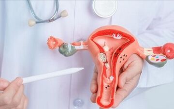 آیا اندومتریوز درمان نشده خطرناک است؟