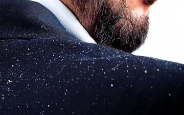 مراقبت از موها در فصل سرما/ هر آن چه که باید بدانید