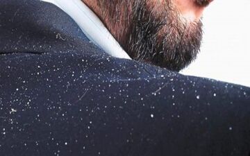 
مراقبت از موها در فصل سرما