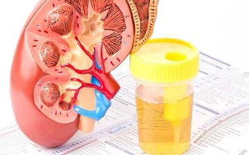 پروتئینوری چیست و چگونه وارد ادار می شود؟