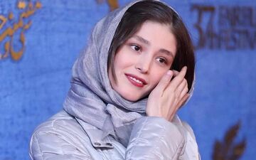 چهره "فرشته حسینی" قبل عمل زیبایی و معروفیت چه شکلی بود؟
