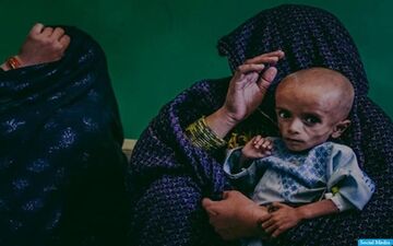 ابتلای نیمی از کودکان زیر ۵ سال افغان به سوء تغدیه شدید