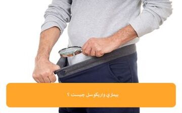  واریکوسل یکی از علل ناباروری در مردان