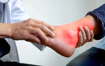 چه زمانی نقرس رخ می‌دهد؟