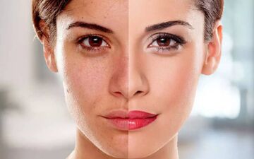 تأثیر تغذیه بر سلامت پوست؛ چه بخوریم تا پوستی درخشان داشته باشیم؟