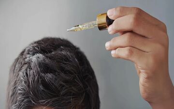 ماینوکسیدیل برای ریزش مو خوب است؟

