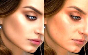 راهکارهایی برای داشتن پوستی بدون جوش