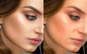 راهکارهایی برای داشتن پوستی بدون جوش