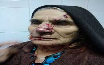 حمله ترسناک گرگ گرسنه/حال عمومی معلم خوب است