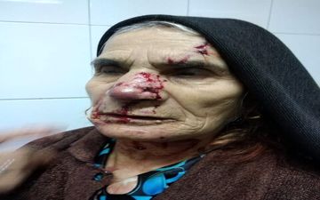 حمله ترسناک گرگ گرسنه/حال عمومی معلم خوب است