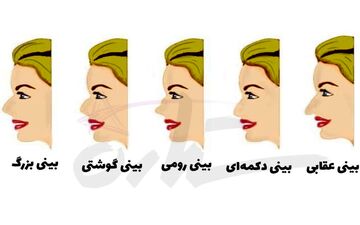 تست شخصیت شناسی | به فرم بینی اطرافیانت دقت کن و به شخصیت آنها پی ببر