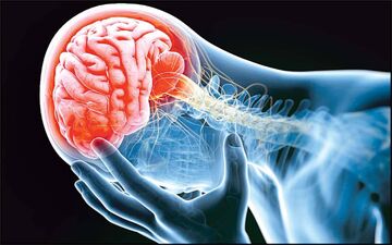 ارتباط آسیب نخاعی و افزایش خطر سکته مغزی