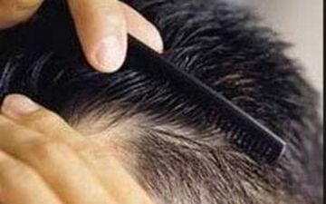 افزایش رشد موها با این روغن خاص
