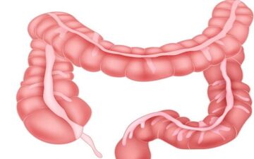 معجزه مصرف این گیاه برای سلامت روده شما که از آن بی خبرید