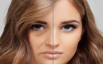 از مشکلات و عوارض وحشتناک تزریق چربی خبر دارید؟
