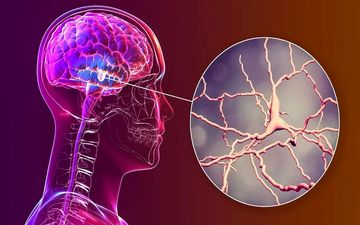 نتایج امیدوارکننده یک ساختار نانویی برای مقابله با پارکینسون

