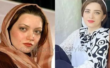 بهنوش طباطبایی با 100 میلیون دگرگون شد | چهار عمل زیبایی که بهنوش طباطبایی را جوان کرد + عکس