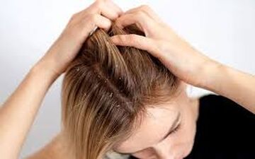 علت خارش کف سر چیست؟