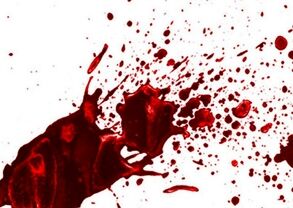 خیانت، قتل و آتش؛ پایان هولناک عشق پنهانی زن جوان و دوست شوهرش!