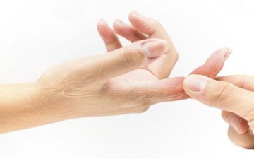 خم شدن انگشت دست چه دلیلی دارد؟