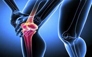 6 راهکار اساسی برای استحکام استخوان