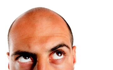 برای مقابله با ریزش مو،راهی وجود دارد؟ 