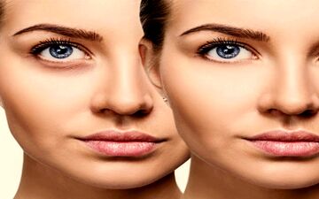 راهکارهای مؤثر برای رفع گودی زیر چشم| گودی زیر چشم را سه سوته درمان کنید