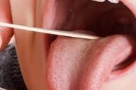 بزاق دهانتان چه چیزی را آشکار میکند؟