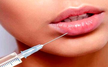 فیلر لب؛ چه چیزهایی را قبل از تزریق فیلر باید بدانید؟
