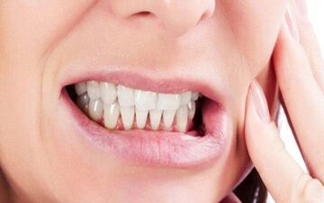 نکته طلایی برای پیشگیری از پوسیدگی دندان