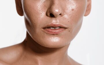 دلایل چرب شدن پوست و نکاتی برای درمان و مراقبت از پوست صورت چرب
