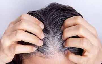 چکار کنیم از سفید شدن مو جلوگیری کنیم؟