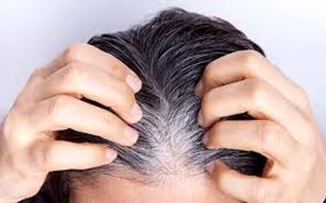 چکار کنیم از سفید شدن مو جلوگیری کنیم؟