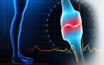  سه راهکار اساسی در پیشگیری از پوکی استخوان