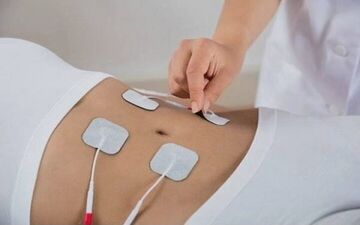 تاثیر فیزیوتراپی بر کاهش فاصله عضلات راست شکمی بعد از بارداری