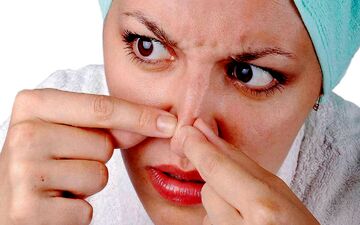 چگونه با آکنه هایمان خداحافظی کنیم؟