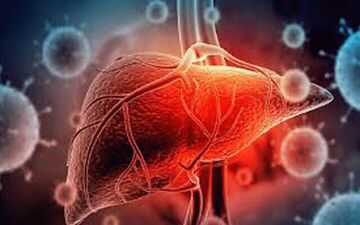 روشی ساده برای داشتن کبدی سالم