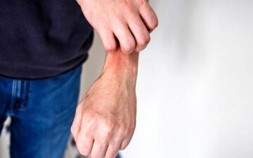 این خارش ها را جدی بگیرید