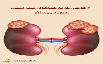 ارتباط یبوست با بیماریهای کلیه!