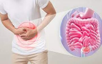 یبوست بجز تغذیه چه دلایلی دارد؟